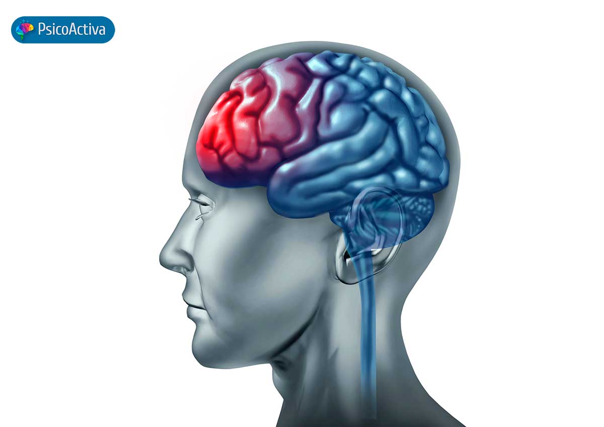 Lesiones del lóbulo frontal cuáles son sus consecuencias PsicoActiva