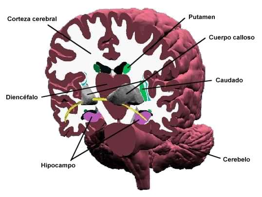 corte cerebro frontal2